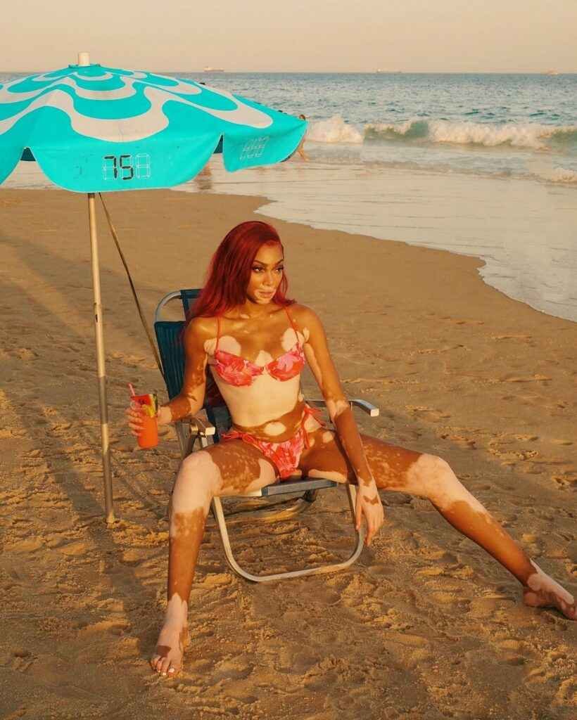 Winnie Harlow en bikini sexy
